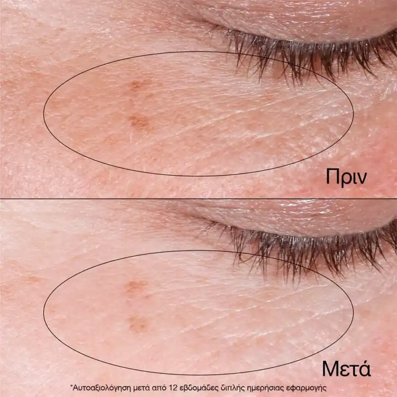 NEUTROGENA Collagen Bank Reviving Eye Gel Cream, 15g - Image 4