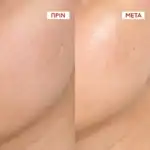 VICHY Liftactiv Collagen Specialist 16 Collagel Gel Προσώπου για Λάμψη, 50ml - Image 3