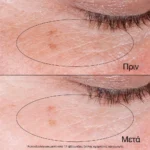 NEUTROGENA Collagen Bank Reviving Eye Gel Cream, 15g - Image 4